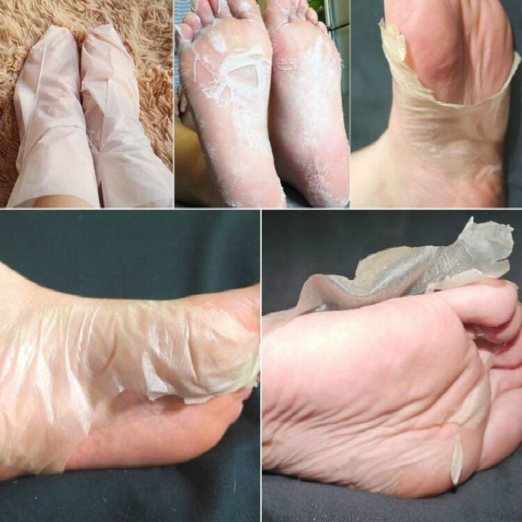 Best ideas about Foot Peel DIY
. Save or Pin Best 25 Foot peel ideas on Pinterest Now.