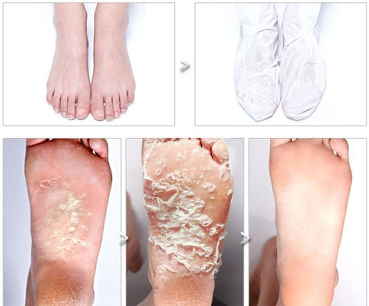 Best ideas about Foot Peel DIY
. Save or Pin 1000 ideas about Foot Peel on Pinterest Now.