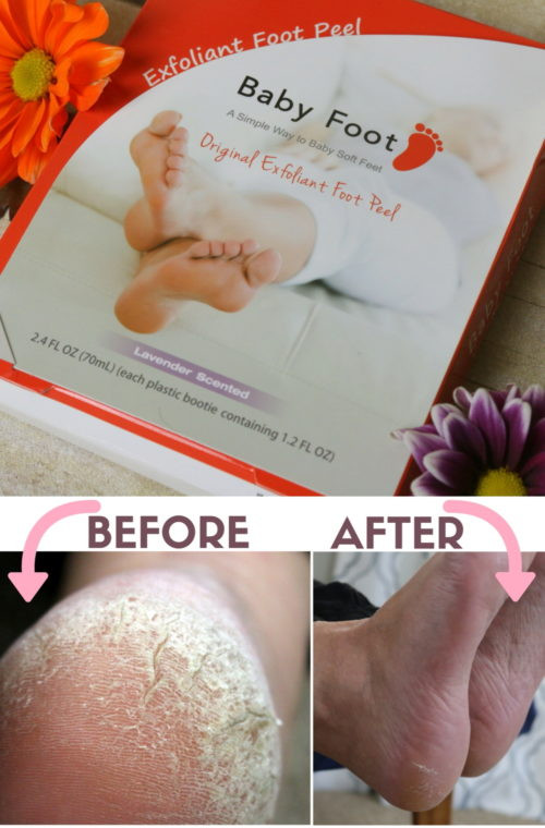 Best ideas about Foot Peel DIY
. Save or Pin Does Baby Foot Really Work Page 3 of 3 The Crafty Now.