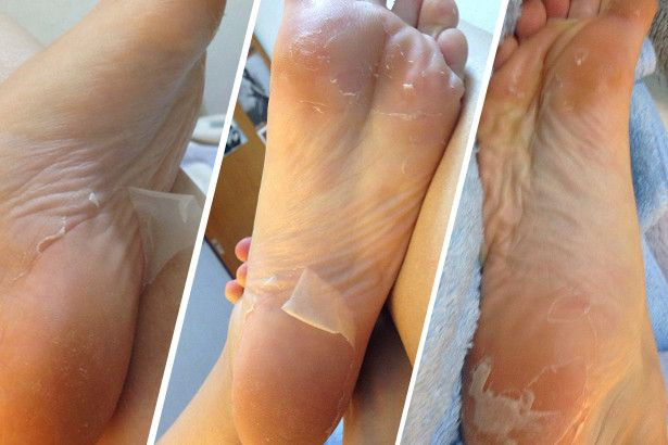 Best ideas about Foot Peel DIY
. Save or Pin 25 best ideas about Japanese babies on Pinterest Now.