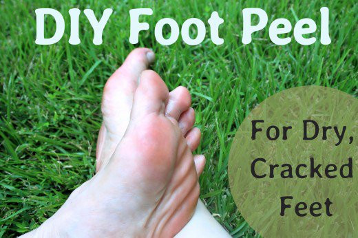 Best ideas about Foot Peel DIY
. Save or Pin A DIY Peel for Dry Cracked Feet Now.