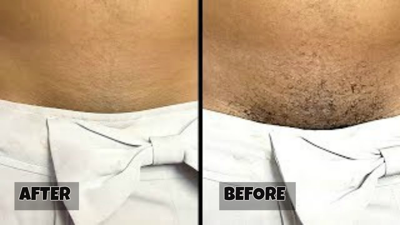 Best ideas about How To Cut Pubic Hair Male
. Save or Pin STOP SHAVING THIS IS HOW YOU SHOULD REMOVE PUBIC HAIR Now.