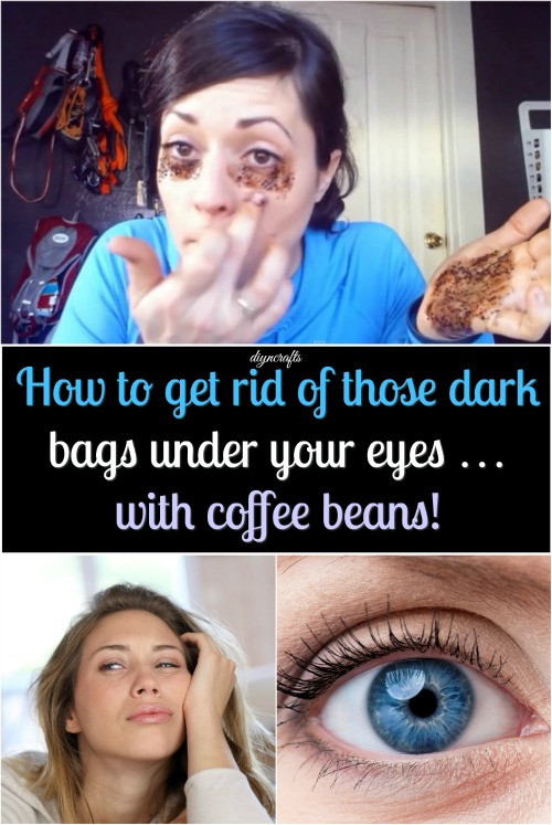 Best ideas about How To Get Rid Of Bags Under Eyes DIY
. Save or Pin How to Get Rid of Dark Bags under your eyes with Coffee Now.