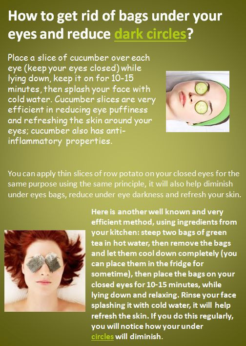 Best ideas about How To Get Rid Of Bags Under Eyes DIY
. Save or Pin How to rid of bags under your eyes and reduce dark Now.