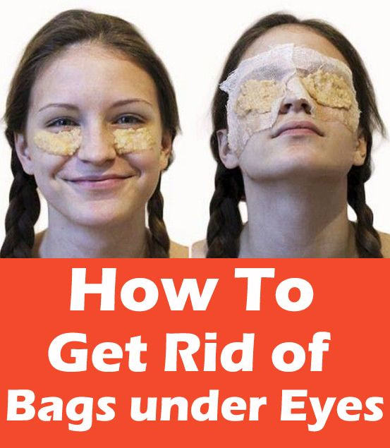 Best ideas about How To Get Rid Of Bags Under Eyes DIY
. Save or Pin Under eyes How to rid and How to on Pinterest Now.