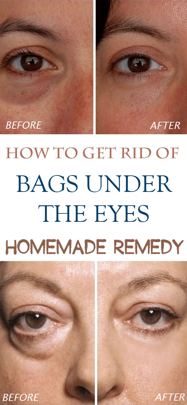 Best ideas about How To Get Rid Of Bags Under Eyes DIY
. Save or Pin Homemade reme s for bags under eyes Indiscreet Beauty Now.