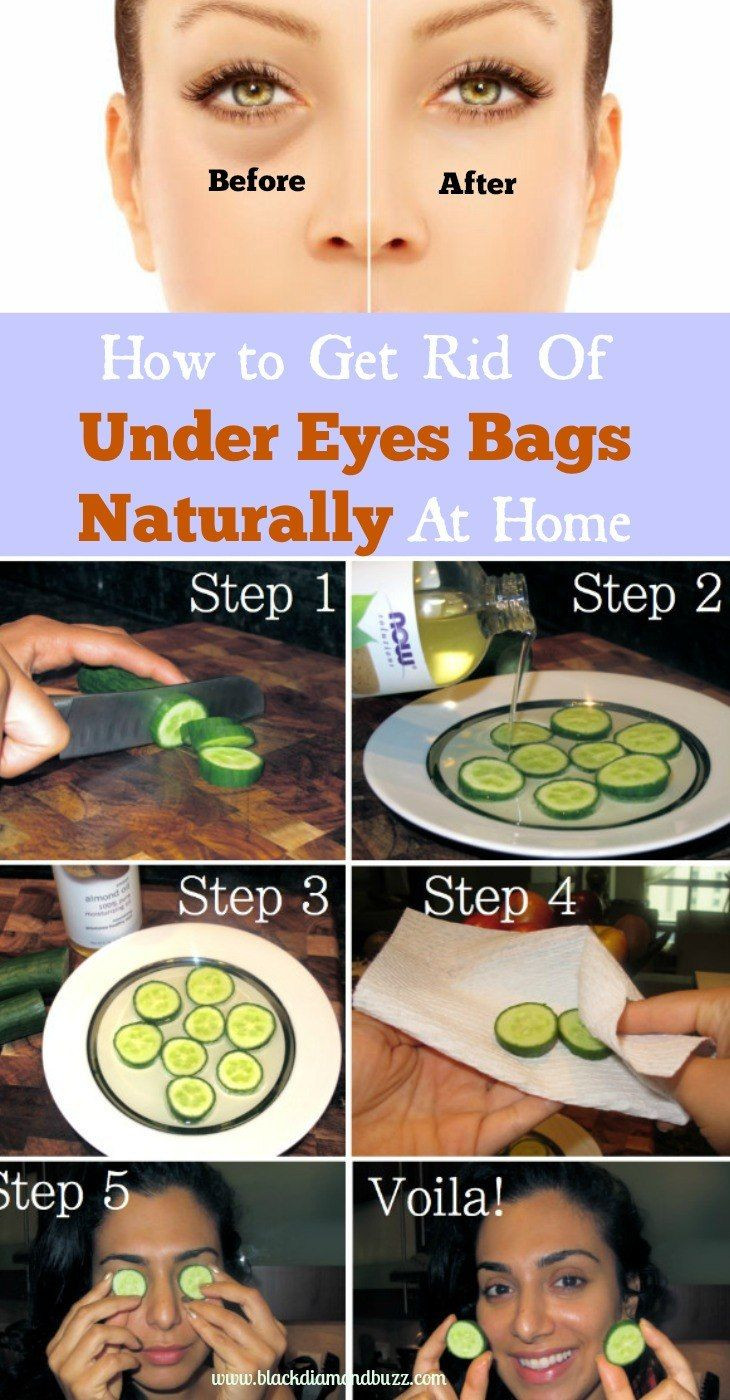 Best ideas about How To Get Rid Of Bags Under Eyes DIY
. Save or Pin 25 best ideas about Under eye bags on Pinterest Now.
