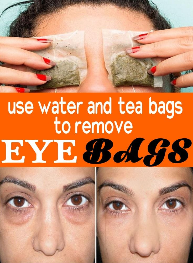 Best ideas about How To Get Rid Of Bags Under Eyes DIY
. Save or Pin 1000 ideas about Under Eye Bags on Pinterest Now.