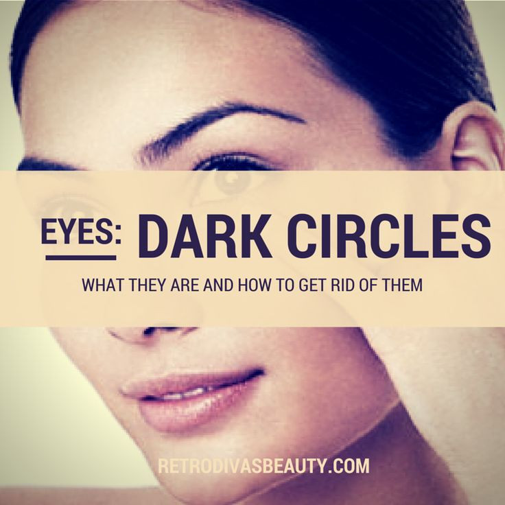Best ideas about How To Get Rid Of Bags Under Eyes DIY
. Save or Pin How to rid of dark circles puffiness and bags under Now.