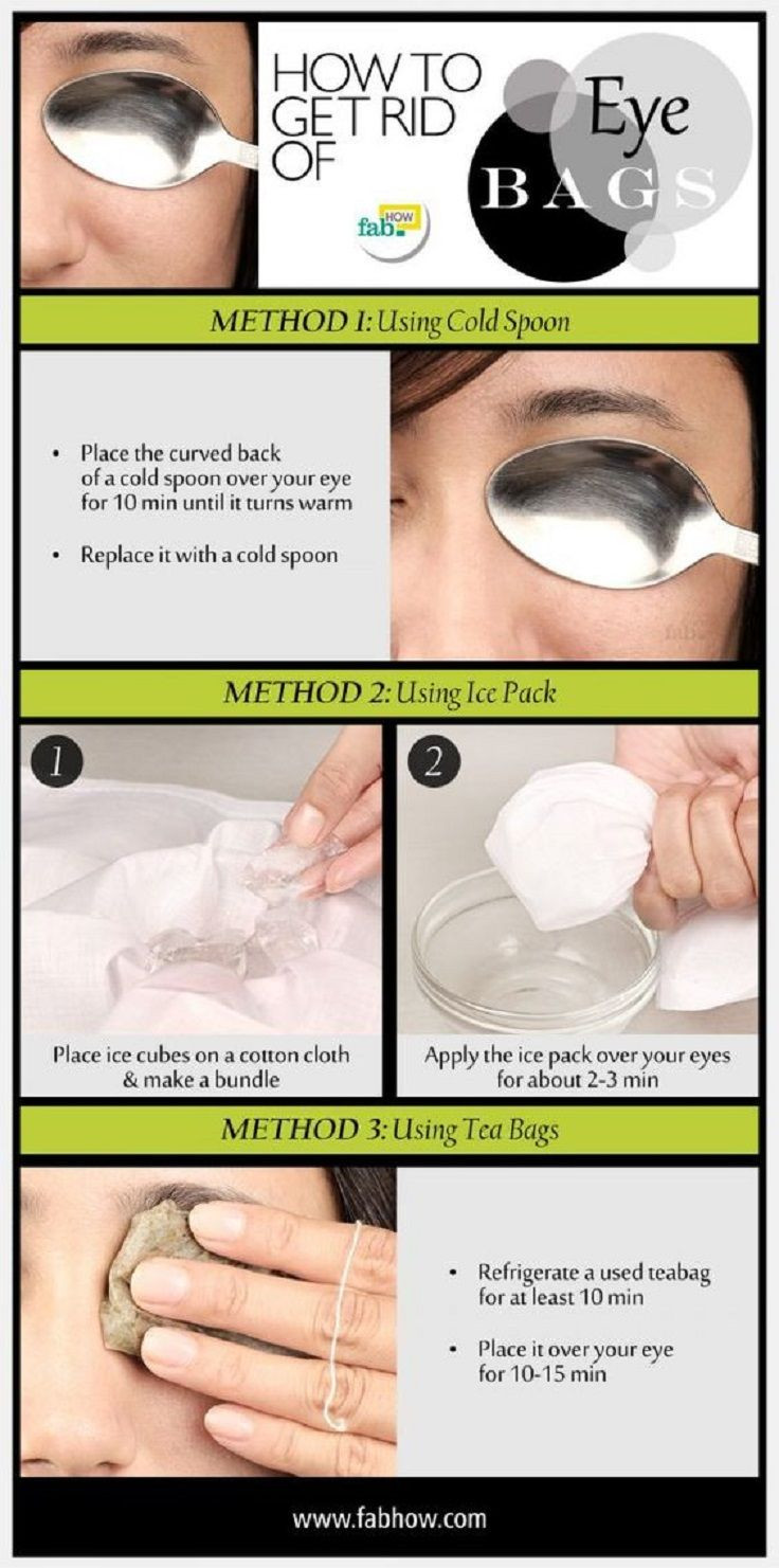 Best ideas about How To Get Rid Of Bags Under Eyes DIY
. Save or Pin Best 25 Dark circle reme s ideas on Pinterest Now.
