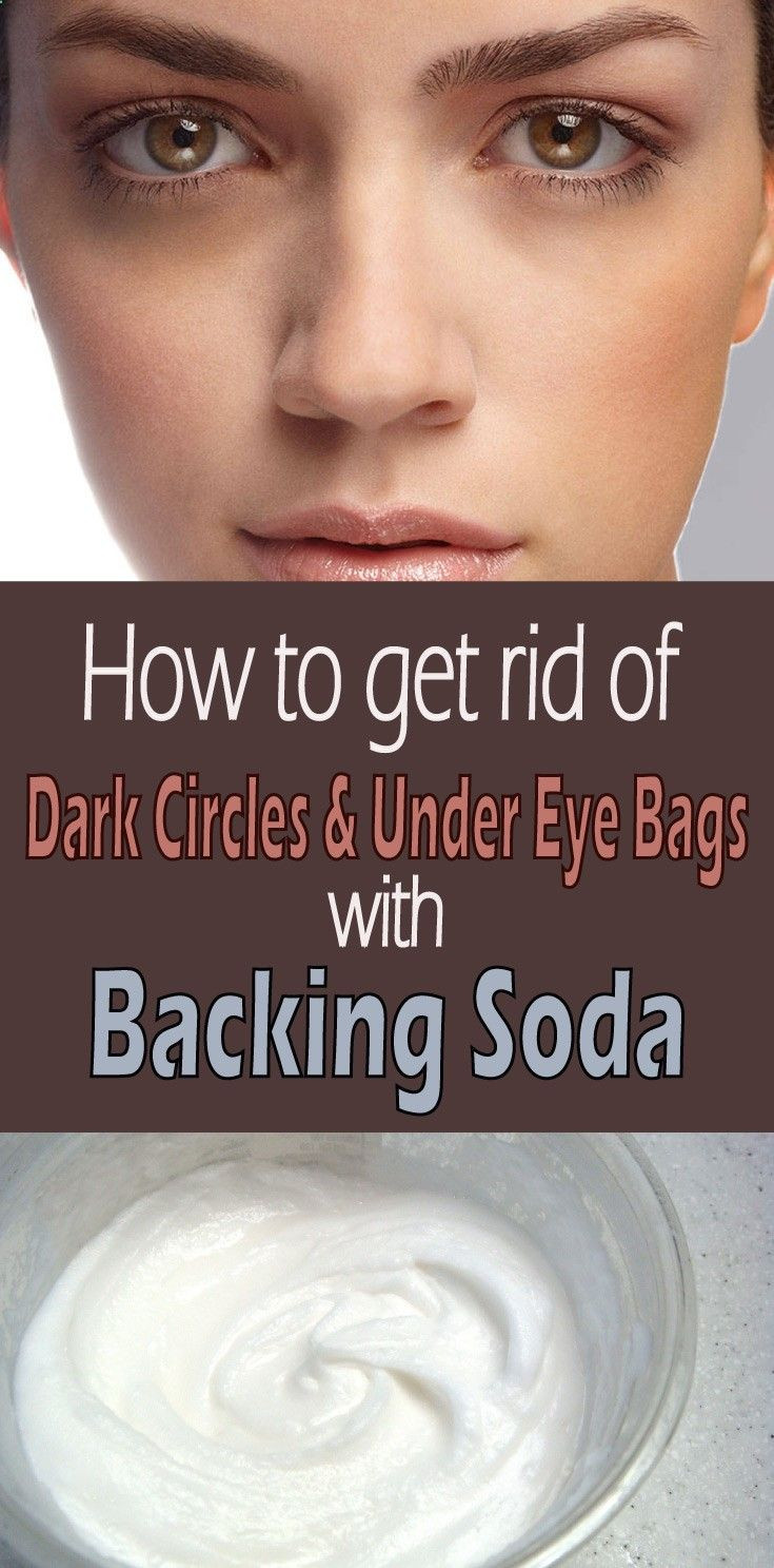Best ideas about How To Get Rid Of Bags Under Eyes DIY
. Save or Pin Best 25 Under eye bags ideas on Pinterest Now.