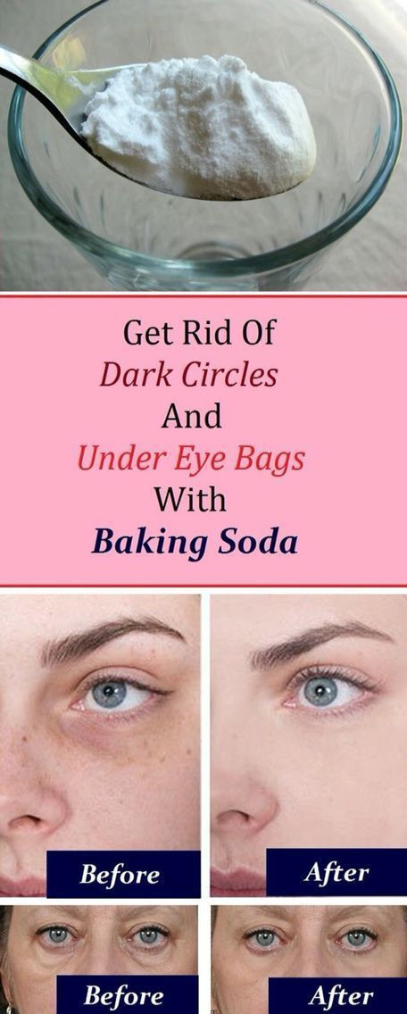 Best ideas about How To Get Rid Of Bags Under Eyes DIY
. Save or Pin 537 best images about Beauty & Health Aids on Pinterest Now.