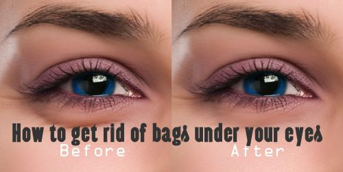 Best ideas about How To Get Rid Of Bags Under Eyes DIY
. Save or Pin How to rid of bags under your eyes Now.