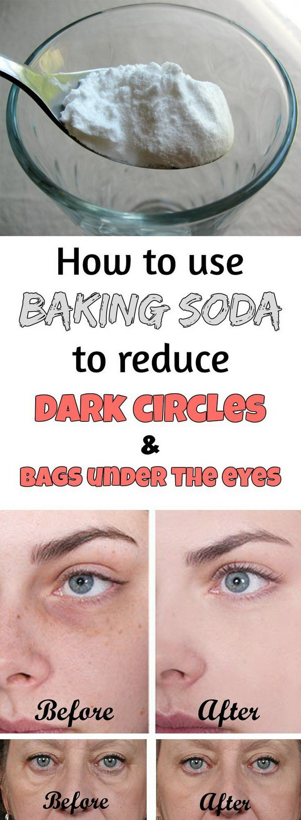 Best ideas about How To Get Rid Of Bags Under Eyes DIY
. Save or Pin 15 Ways to Get Rid of Dark Circles Under Your Eyes Hative Now.