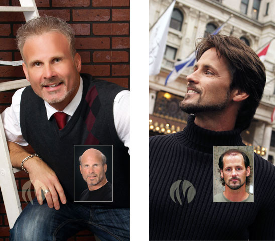 Best ideas about Mens Haircuts Minneapolis
. Save or Pin Men s Hair Replacement Minneapolis Now.