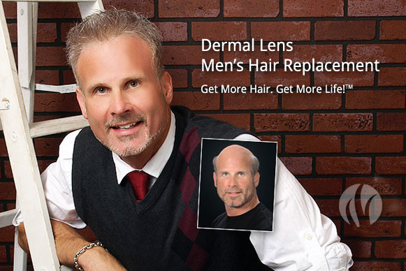 Best ideas about Mens Haircuts Minneapolis
. Save or Pin Men s Hair Replacement Minneapolis Now.