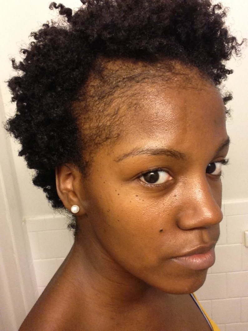 Best ideas about No Edges Hairstyles
. Save or Pin Help My Edges Are Starting To Thin What Could Be The Now.