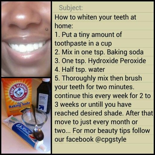 Best ideas about Teeth Whitening DIY
. Save or Pin Diy teeth whittening kit Home kit you can make yourself Now.