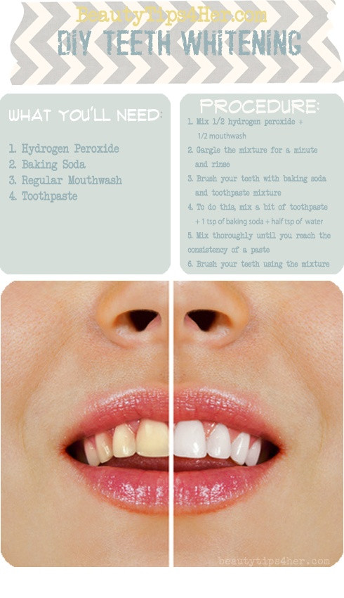 Best ideas about Teeth Whitening DIY
. Save or Pin Homemade Teeth Whitening AllDayChic Now.