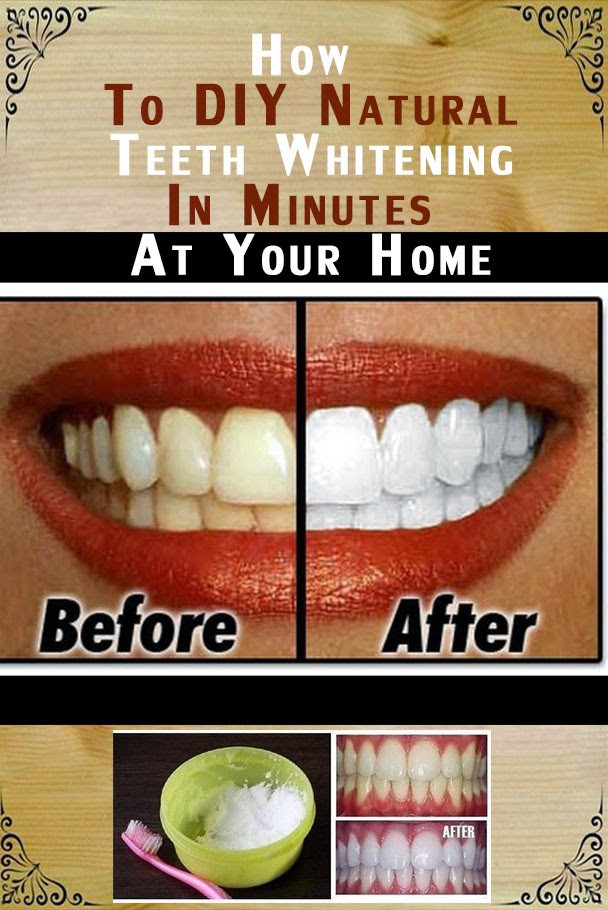 Best ideas about Teeth Whitening DIY
. Save or Pin How to DIY Natural Teeth Whitening in Minutes at Your Home Now.